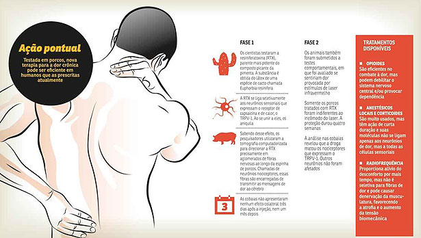 Cientistas desenvolvem potente anestésico contra a dor crônica
