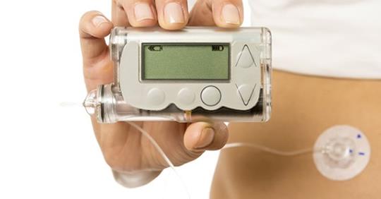 Iniciada pesquisa para testar glucagon líquido em um pâncreas artificial