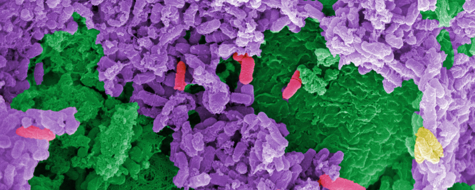 105.Três Estudos Rastreiam os Microbiomas das Pessoas Através da Saúde e da Doença