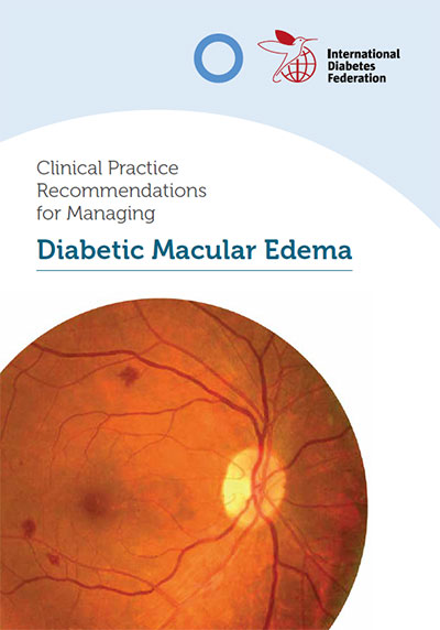 Edema Macular Diabético (DME)