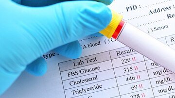 Sucesso de ICP vs Medicamentos Apenas em Diabetes Pode Depender do Controle de LDL-C